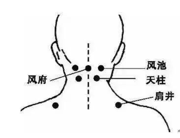 风池和天柱的位置图,天柱与风池相对位置图,天柱的准确位置图(第11页)_大山谷图库